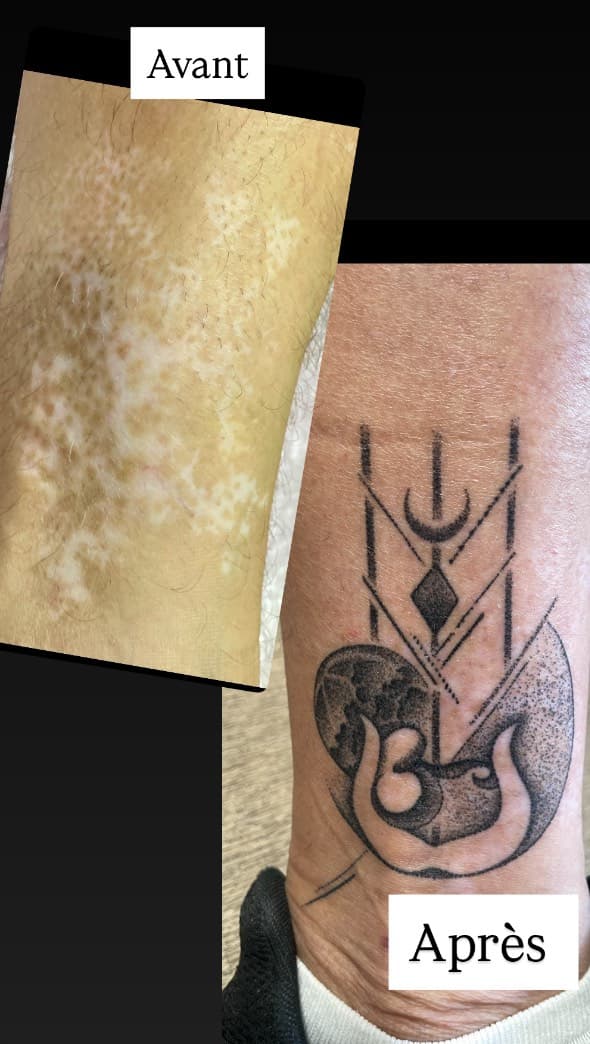 Tatouage de Holist’ink tattoo therapie